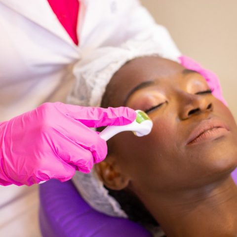 Revela | Tratamento de manchas e cicatrizes de acne